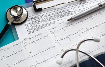 Picture of Electrocardiogram Readout